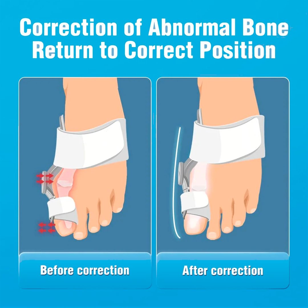 Orthopedic Bunion Toe Straightener